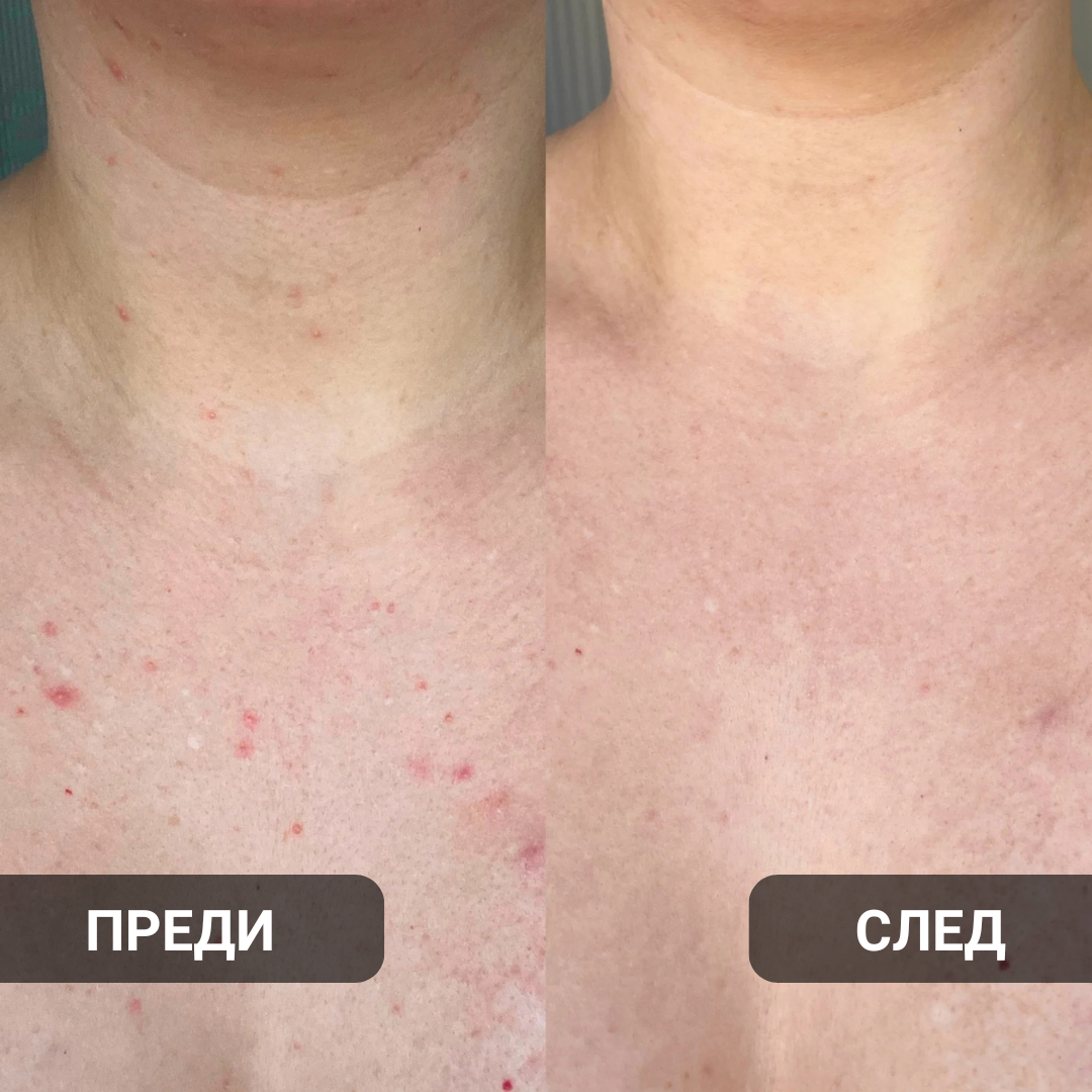 Glow Factory Ексфолиращ Стик За Тяло