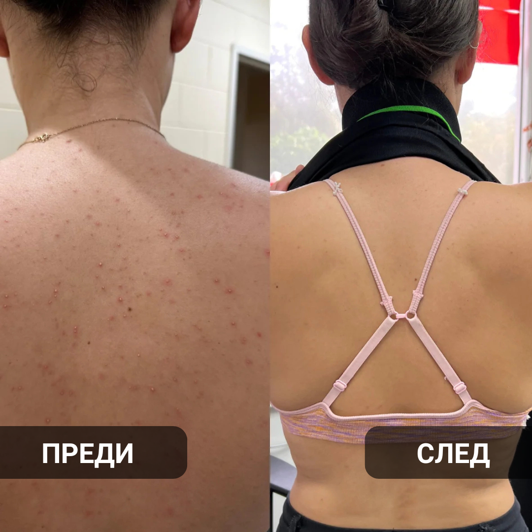 Glow Factory Ексфолиращ Стик За Тяло