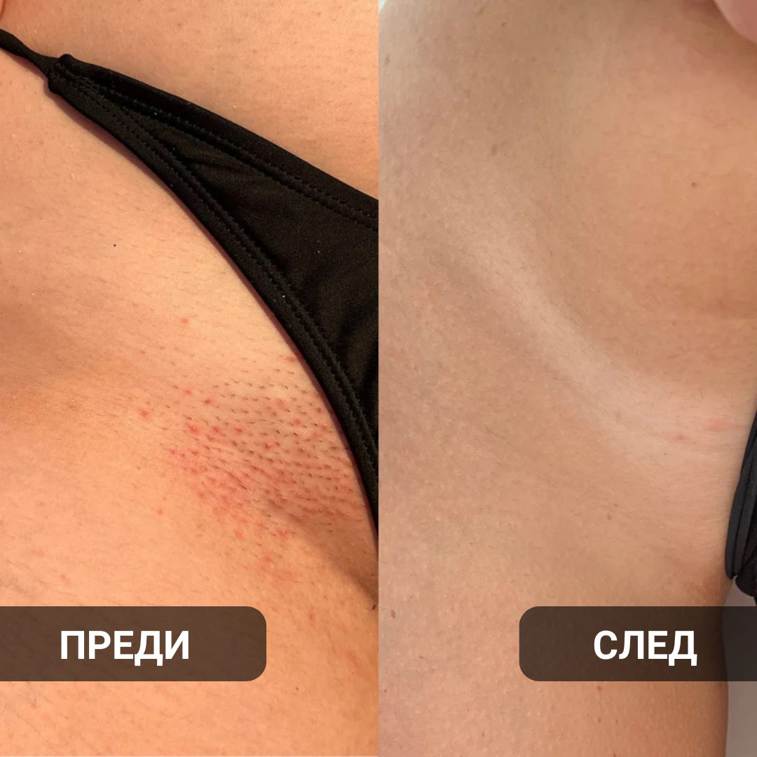 Glow Factory Ексфолиращ Стик За Тяло