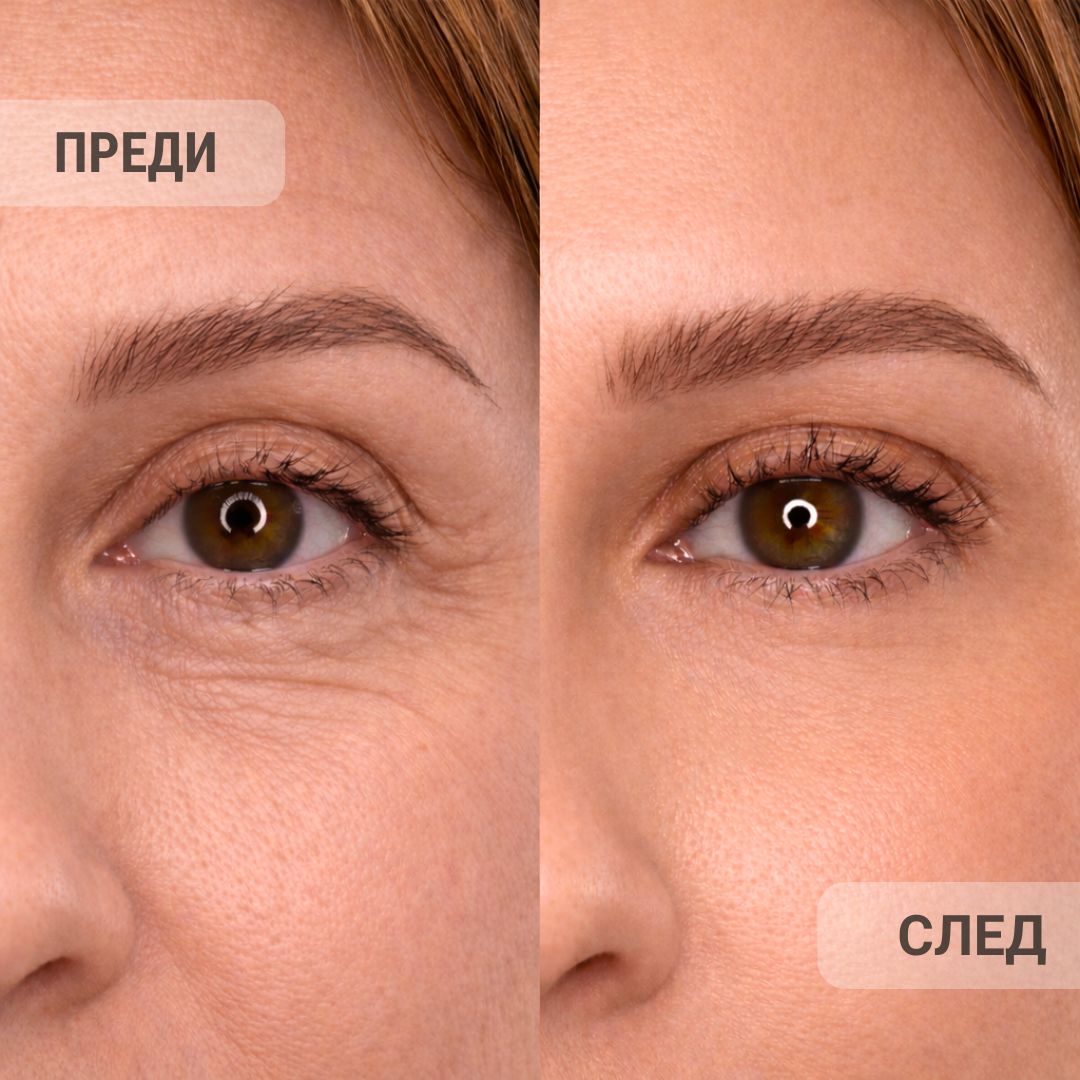 Glow Factory Интензивен Серум с Matrixyl