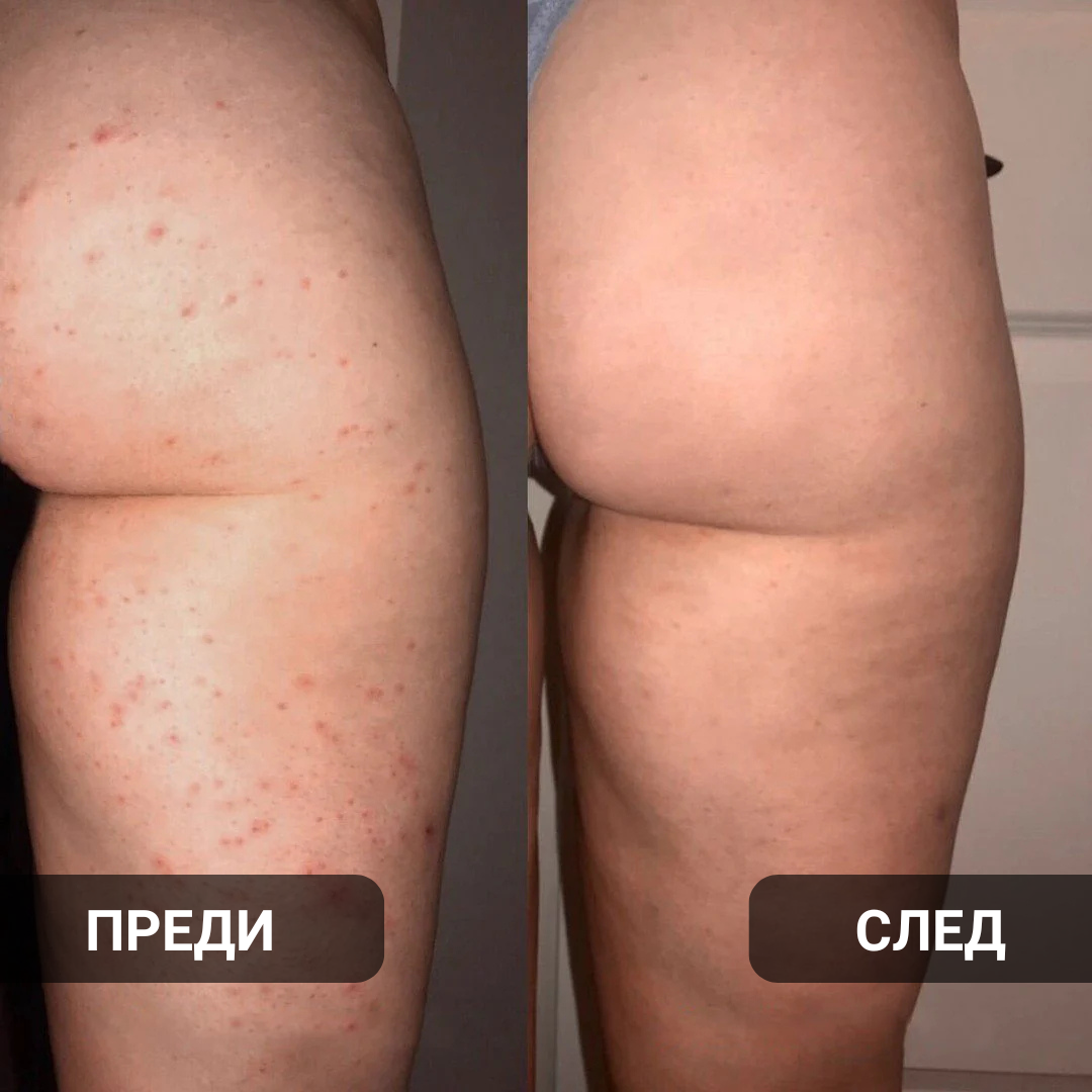 Glow Factory Ексфолиращ Стик За Тяло