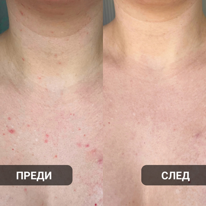 Glow Factory Ексфолиращ Стик За Тяло